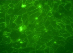 Human Brain Microvascular Endothelial Cells Expressing GFP-VE-CAD