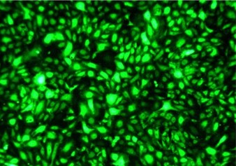 Human Brain Microvascular Endothelial Cell GFP-AEQ in Mitochondria