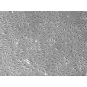 Human Glomerular Microvascular Endothelial Cells