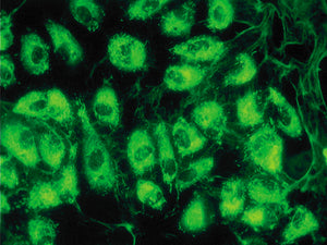 Human Liver Sinusoidal Microvascular Endothelial Cells AEQ-GFP in Mitochondria (HLiSMVECs-AEQ-GFP)