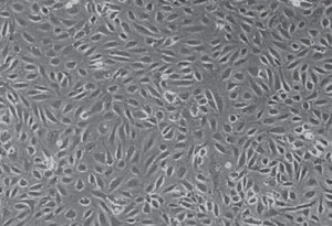 Primary Human Brain Microvascular Endothelial Cells