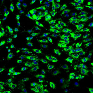 Primary Human Bladder Microvascular Endothelial Cells (HBlMVECs)