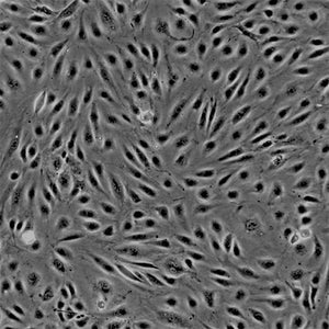 Human Brain Microvascular Endothelial Cell GFP-AEQ in Mitochondria