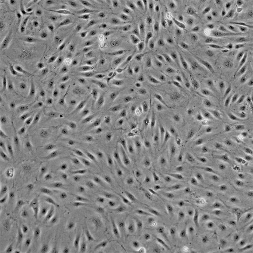 Primary Human Liver Sinusoids Microvascular Endothelial Cells (HLiSMVE ...