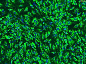 Human Pancreatic Microvascular Endothelial Cells (HPMVECs)