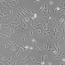 Primary Human Bladder Microvascular Endothelial Cells (HBlMVECs)