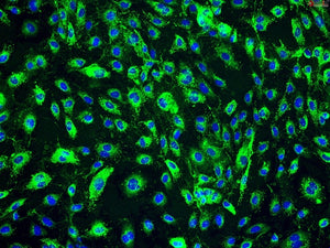 Human Dermal Lympathic Microvascular Endothelial Cells