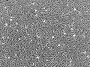 Immortalized Human Dermal Microvascular Endothelial Cells (SV40-HDMVECs)