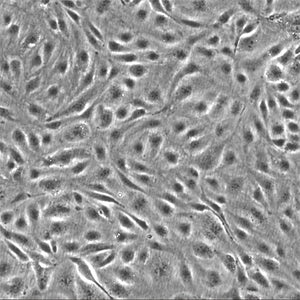 Human Pancreatic Microvascular Endothelial Cells (HPMVECs)