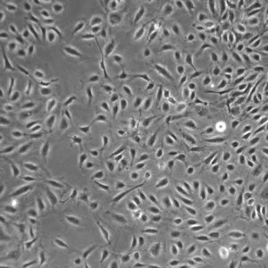 Primary Human Iliac Artery Endothelial Cells (HIlAECs)