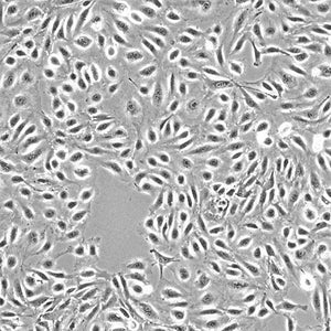 Primary Human Cardiac Microvascular Endothelial Cells (HCMVECs)