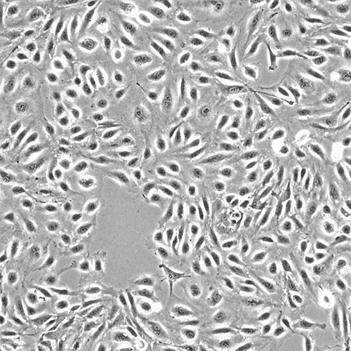 Primary Human Cardiac Microvascular Endothelial Cells (HCMVECs)