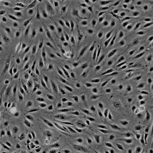 Primary Human Brain Microvascular Endothelial Cells