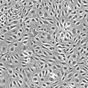 Human Dermal Microvascular Endothelial Cells